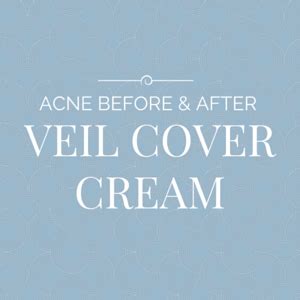 Acne Before And After Veil Cover Cream Veil Cover Cream BlogVeil