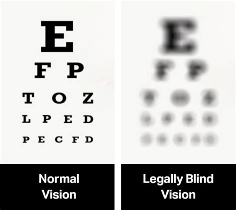 Understand Your Eyeglass Prescription Framesbuy