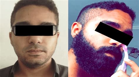 To choose the right style of beard, it is important to understand that the goal is to bring for face oval shape will suit any minoxidil before and after beard. Minoxidil Before And After Beard Result : The Struggle to ...