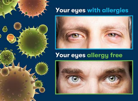 Can You Develop Allergies As An Adult Immuno Labs