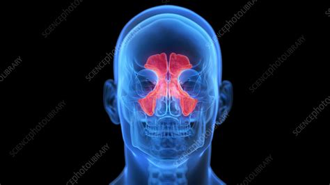 Inflamed Sinuses Illustration Stock Image F0384482 Science
