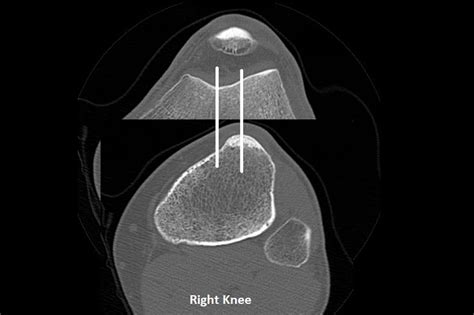 Orthodx Patellofemoral Instability Clinical Advisor