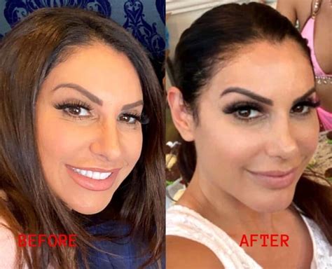 Photos See Jennifer Aydins Before And After Nose Job Photo As Rhonj