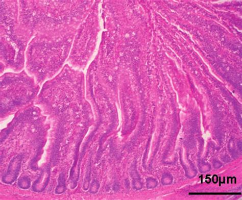 Duodenum Chicken Infected 72 H Previously Extensive Necrotic Lesions