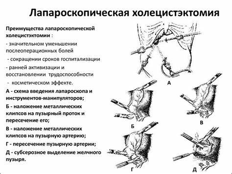Желчекаменная болезнь. Острый и хронический холециститы - презентация Картинка - Желчекаменная болезнь. Острый и хронический холециститы - презентация