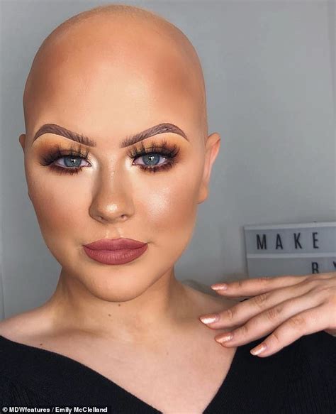 Makeup Artist Reveals She Covered Her Bald Patches With Dry Shampoo