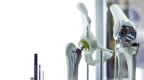 Additive Manufacturing Creating The Next Generation Of Orthopedic