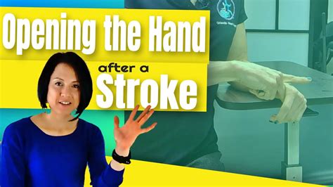 Stroke Arm Exercise Opening A Fisted Hand Youtube