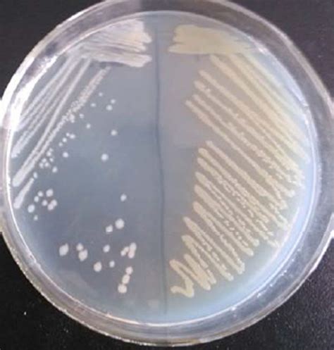 Bacillus Subtilis Colony