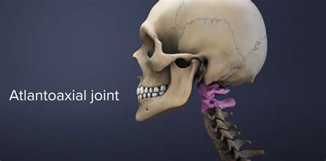 Neck Pain Stabilising The Atlantoaxial Joint