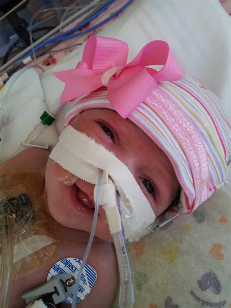 Baby Born With Heart Outside Her Body Is Making Strides