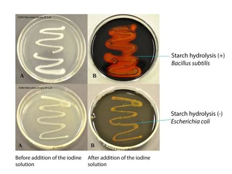 Starch Hydrolysis Test Principle Procedure Results • Microbe Online