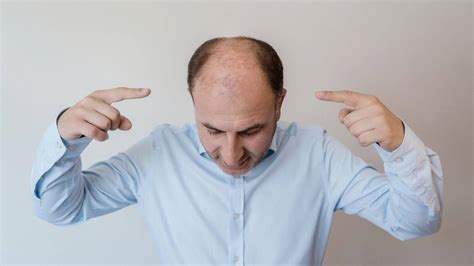 Download Bald Man Pointing At His Head Wallpaper