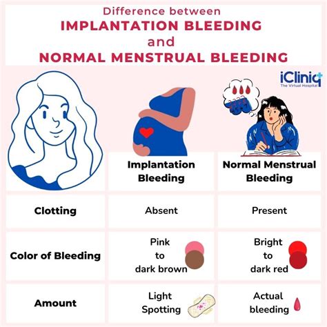 How To Recognize Implantation Bleeding Gehub