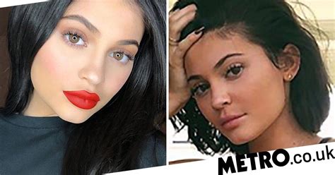Kylie Jenner Removes Iconic Lip Fillers For More Natural Look Metro News