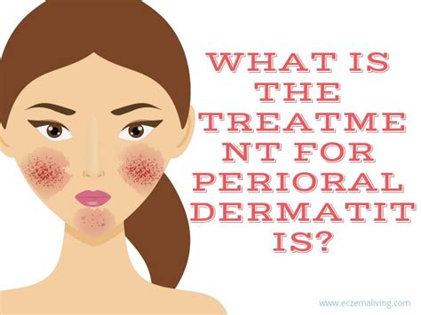 Perioral Dermatitis Causes Symptoms Diagnosis And Treatment