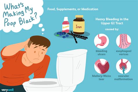 What Are The Causes Of Black Stool Black Stool Black Digestive Health