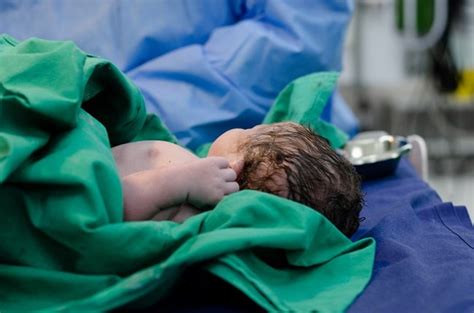 Pemeriksaan Bayi Baru Lahir Teknik Indikasi Komplikasi Pedoman