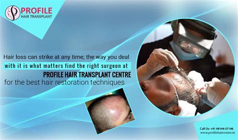 Using #FUE #technique, the hair from back of the #head are ...