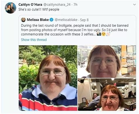 Disabled Blogger Told She Was Too Ugly For Selfies Keeps On Posting Photos In Defiance