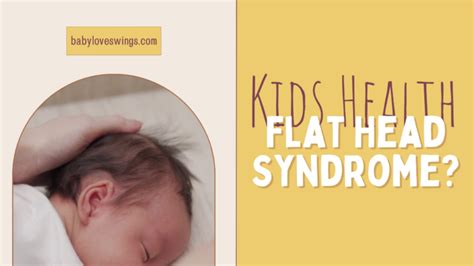 How To Prevent And Cure Flat Head Syndrome In Babies Experts Guide
