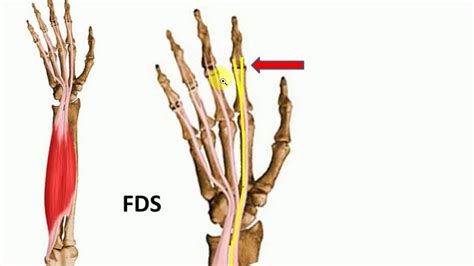 We'll go over all the muscles in your upper arm and forearm as well as explain some common conditions that can affect them. ANATOMY LECTURES , Upper limb , MUSCLES OF FORE ARM ...
