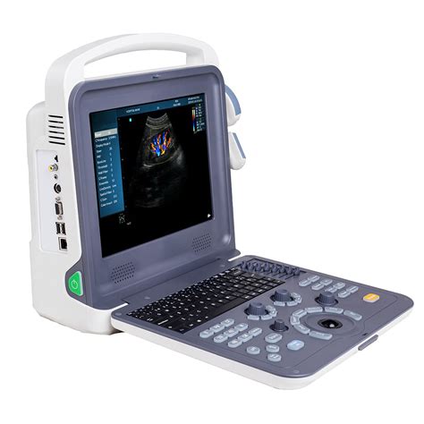 Cheap Portable Color Doppler Ultrasound Scanner For Pregnancy Diagnosis