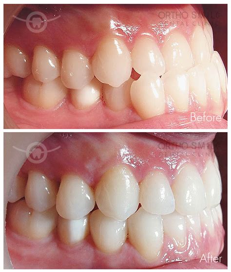Dentist Pattaya Dental Pattaya Implant Pattaya ทำฟัน พัทยา จัดฟัน