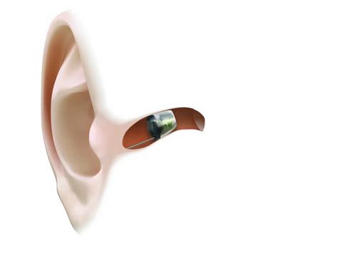 World First And Completely Wireless Hearing Aid