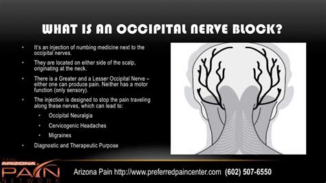 Info On Occipital Nerve Block Procedure From An Az Pain Center 602