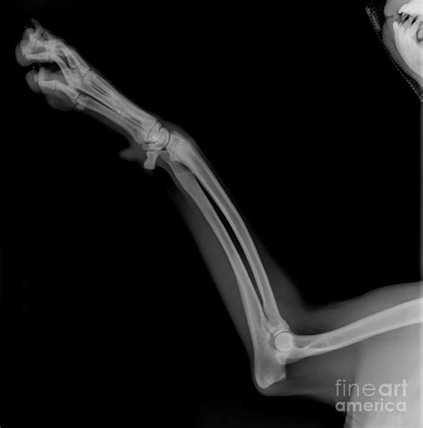 Dogs Front Left Leg Photograph By Photostock Israelscience Photo