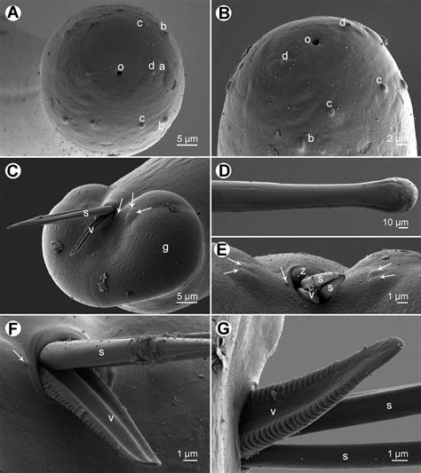 Philometra Brevicollis Sp N Scanning Electron Micrographs Of Male