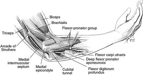 Compressive Neuropathy Of The Ulnar Nerve A Perspective On History And
