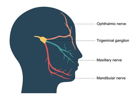 Trigeminal Neuralgia Symptoms Treatment And Causes Healthdirect