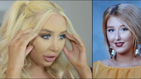 This Finnish Womans Addiction To Plastic Surgery Nearly Killed Her