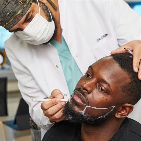 Beard Transplant In Turkey Dr Cinik