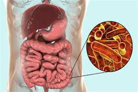 Infectious Causes Of Bloody Diarrhea A Mnemonic Medizzy