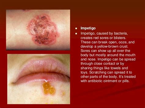 Rashes When To Worry