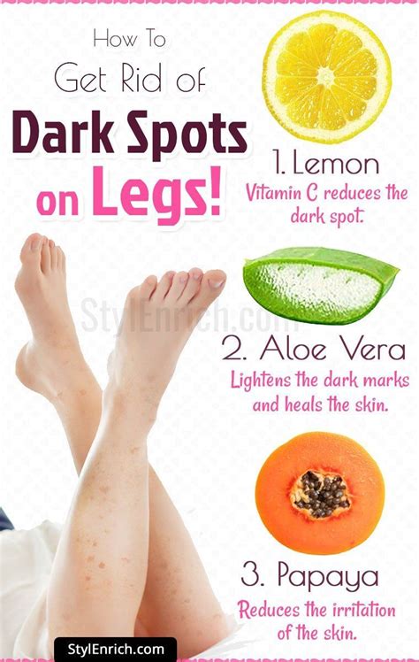 How To Get Rid Of Dark Spots On Legs Dark Spots On Skin Dark Spots