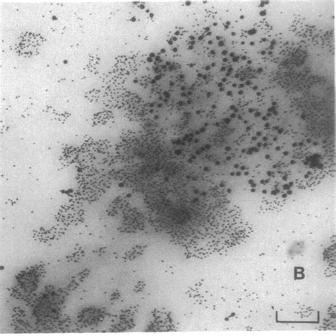 Electron Micrographs Of Human Unbanded Prometaphase X Chromosome