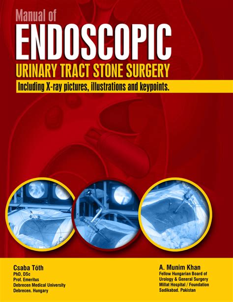 Pdf Endoscopic Urinary Tract Stone Surgery Including X Ray Pictures