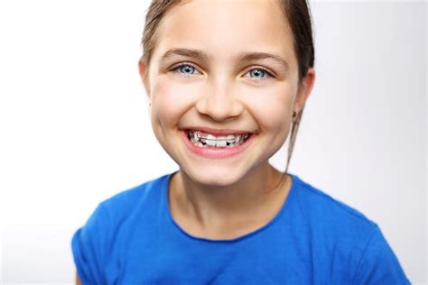 What Age Do Kids Get Braces Orthodontic Blog Ortho Buena Park