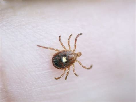 Tick Caused Meat Allergy On The Rise In The United States Medical Bag