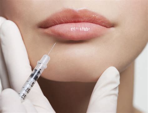 Best Lip Filler Injections In Westwood Lip Filler Treatment In La