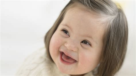Children affected by trisomy usually have a range of there are three types of down syndrome. Tag der Trisomie 21 - Down-Syndrom ist keine Krankheit!