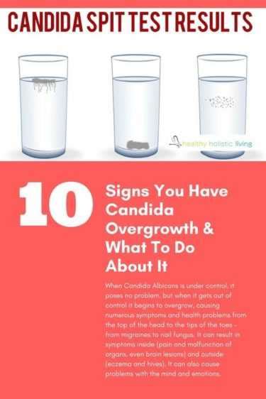 Candida Overgrowth Signs And What To Do About It Healthy Holistic Living