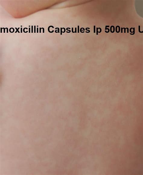 Amoxicillin Capsules Ip 500mg Uses Amoxicillin Trihydrate Capsules Ip