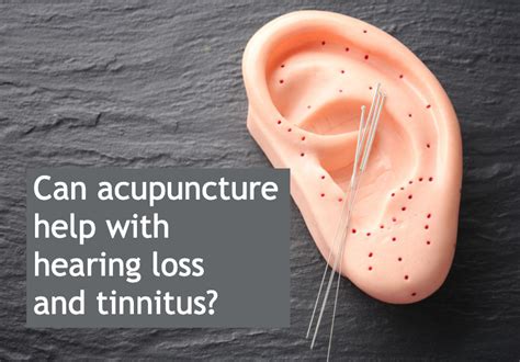 Acupuncture For Hearing Loss Or Tinnitus Will It Help