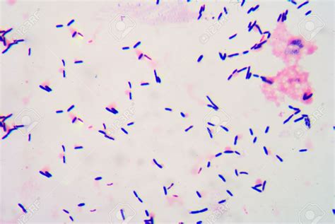 Bacteriologia Aerobios