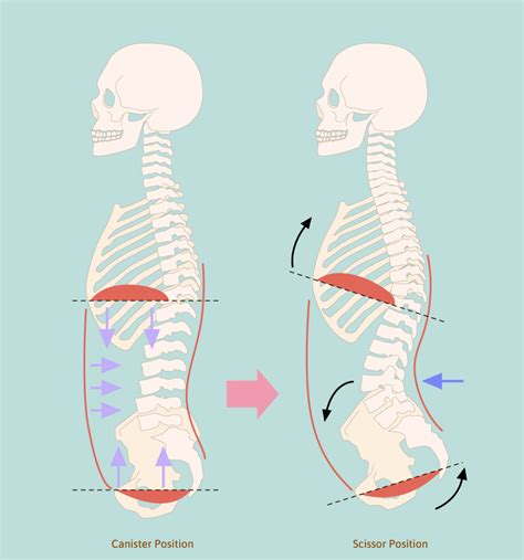 Stacking The Ribcage And Pelvis What It Means Why It Matters And How